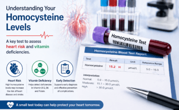 Homocysteine blood test showing lab sample and report used to assess heart disease risk and detect vitamin B12, B6, and folate deficiencies